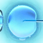 Fécondation in vitro FIV ICSI