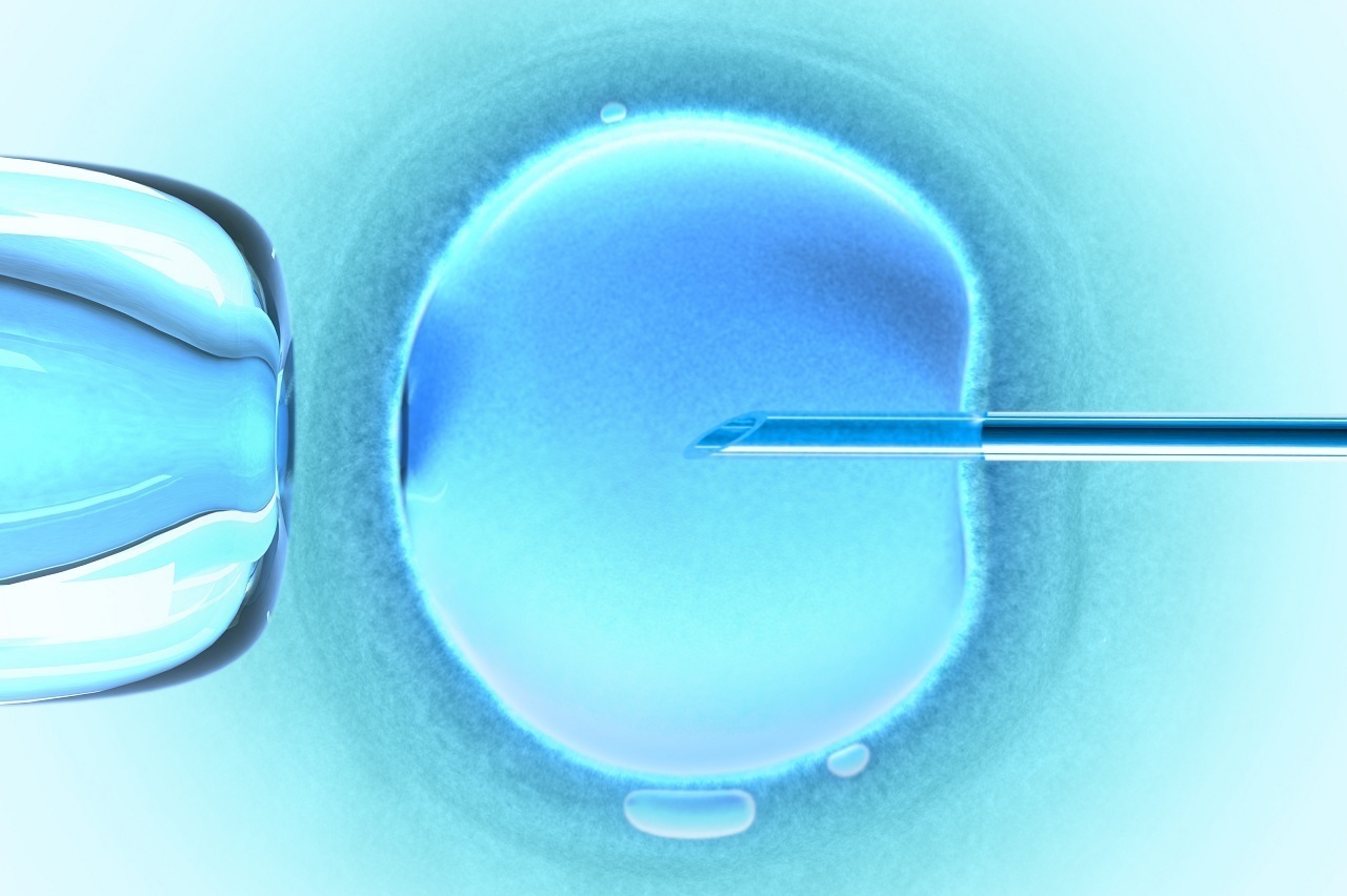 Fécondation in vitro FIV ICSI