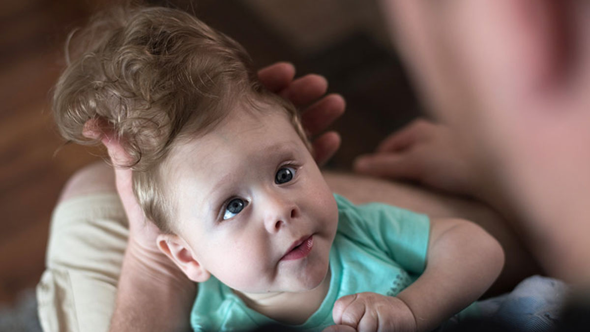 Elle Nait Avec Une Partie De Son Cerveau Hors De Son Crane Maman Co