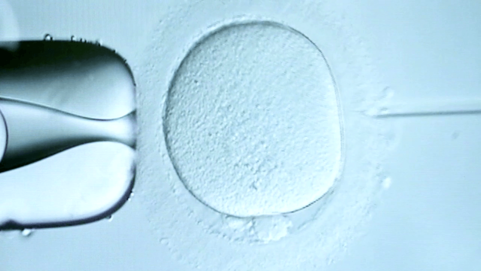 Fécondation in-vitro FIV ICSI
