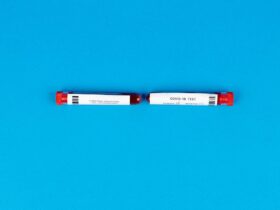 découvrez l'importance des tests négatifs, leur rôle dans la validation des hypothèses et comment interpréter leurs résultats efficacement.