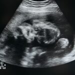 tout savoir sur la grossesse : conseils, développement du bébé, bien-être de la future maman et préparation à l'accouchement.