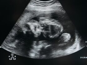 tout savoir sur la grossesse : conseils, développement du bébé, bien-être de la future maman et préparation à l'accouchement.