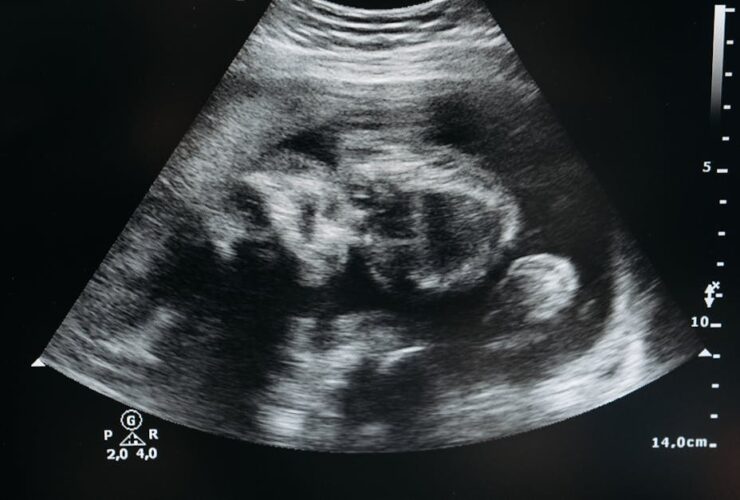 tout savoir sur la grossesse : conseils, développement du bébé, bien-être de la future maman et préparation à l'accouchement.