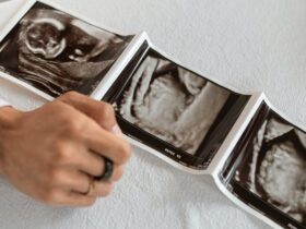 découvrez les bienfaits du yaourt pendant la grossesse, ses apports nutritionnels essentiels et conseils de consommation pour une maternité en bonne santé.