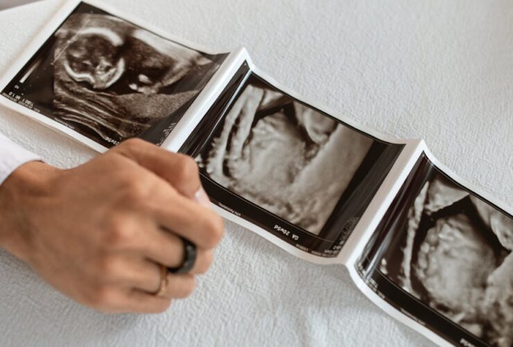 découvrez les bienfaits du yaourt pendant la grossesse, ses apports nutritionnels essentiels et conseils de consommation pour une maternité en bonne santé.