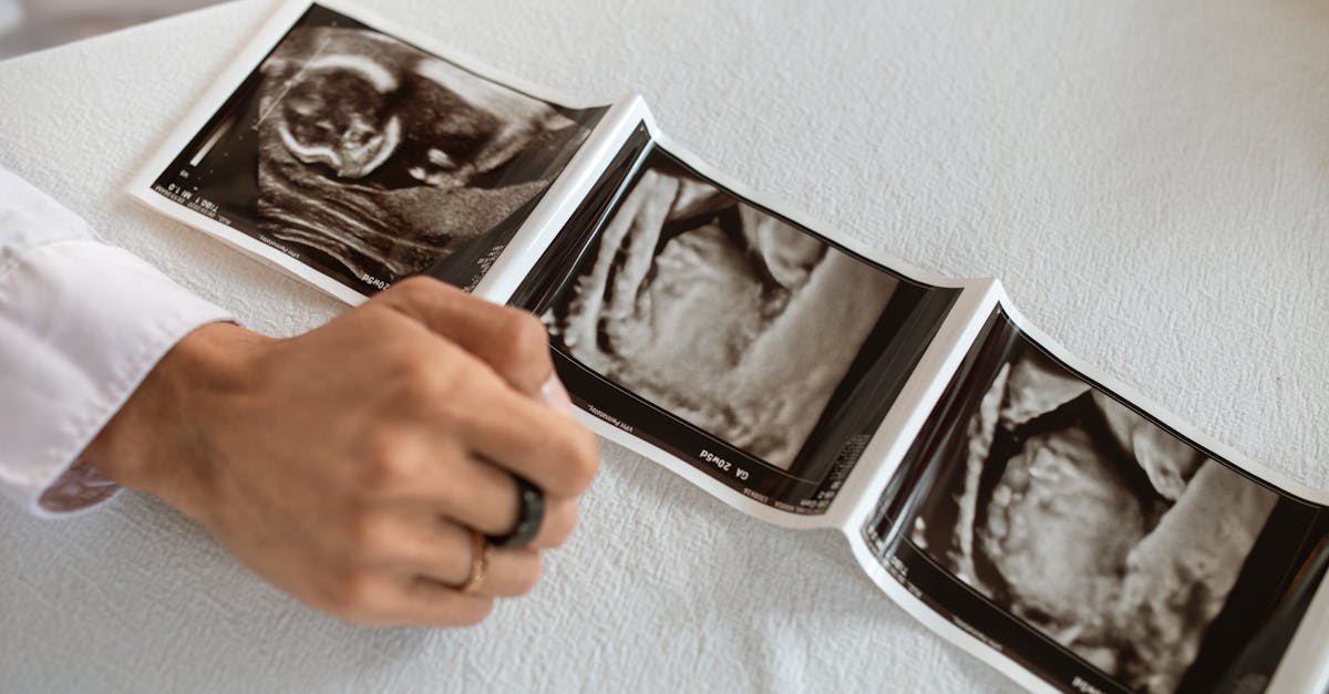 découvrez les bienfaits du yaourt pendant la grossesse, ses apports nutritionnels essentiels et conseils de consommation pour une maternité en bonne santé.